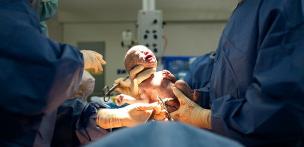 Parto vaginal após cesariana