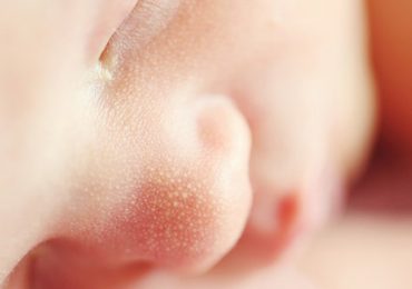 Milium no recém-nascido e bebé: causas e tratamento