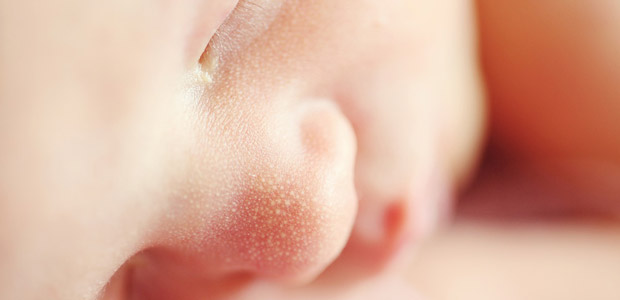 Milium no recém-nascido e bebé: causas e tratamento