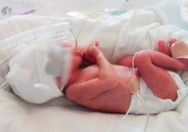 Bebé nasce de grávida com Covid-19, em coma e ventilada