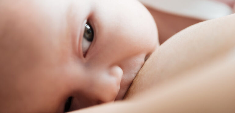 Ingurgitamento mamário: o que é e como tratar