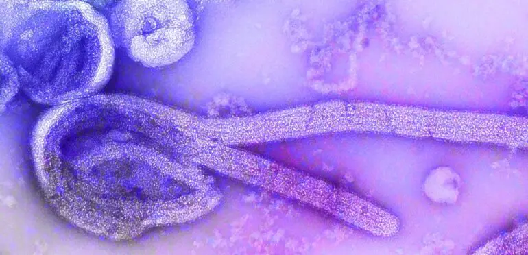 Ébola: o que é, sintomas e como se proteger